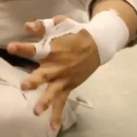thumb-osiander-taping-1.png